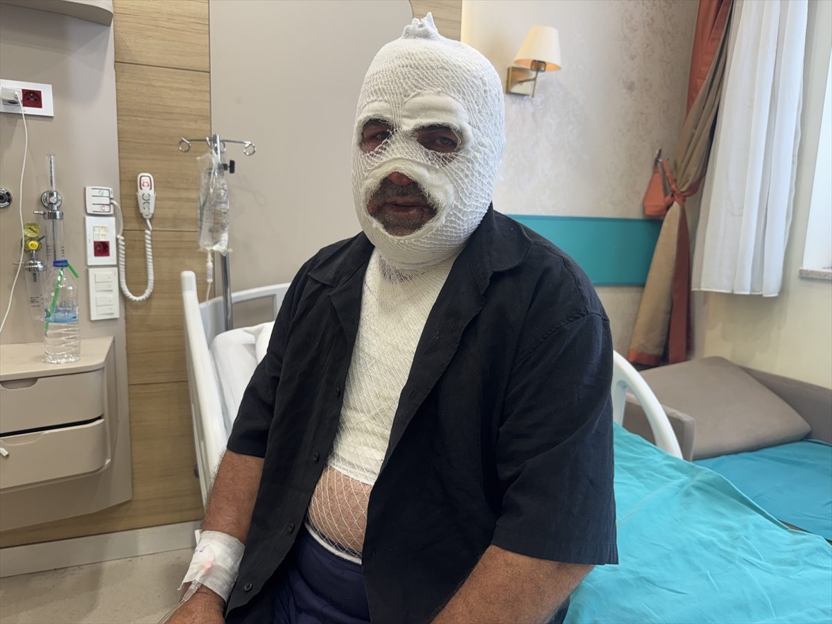 Hararet yapan araca acele müdahale ikinci derece yanığa neden oldu
