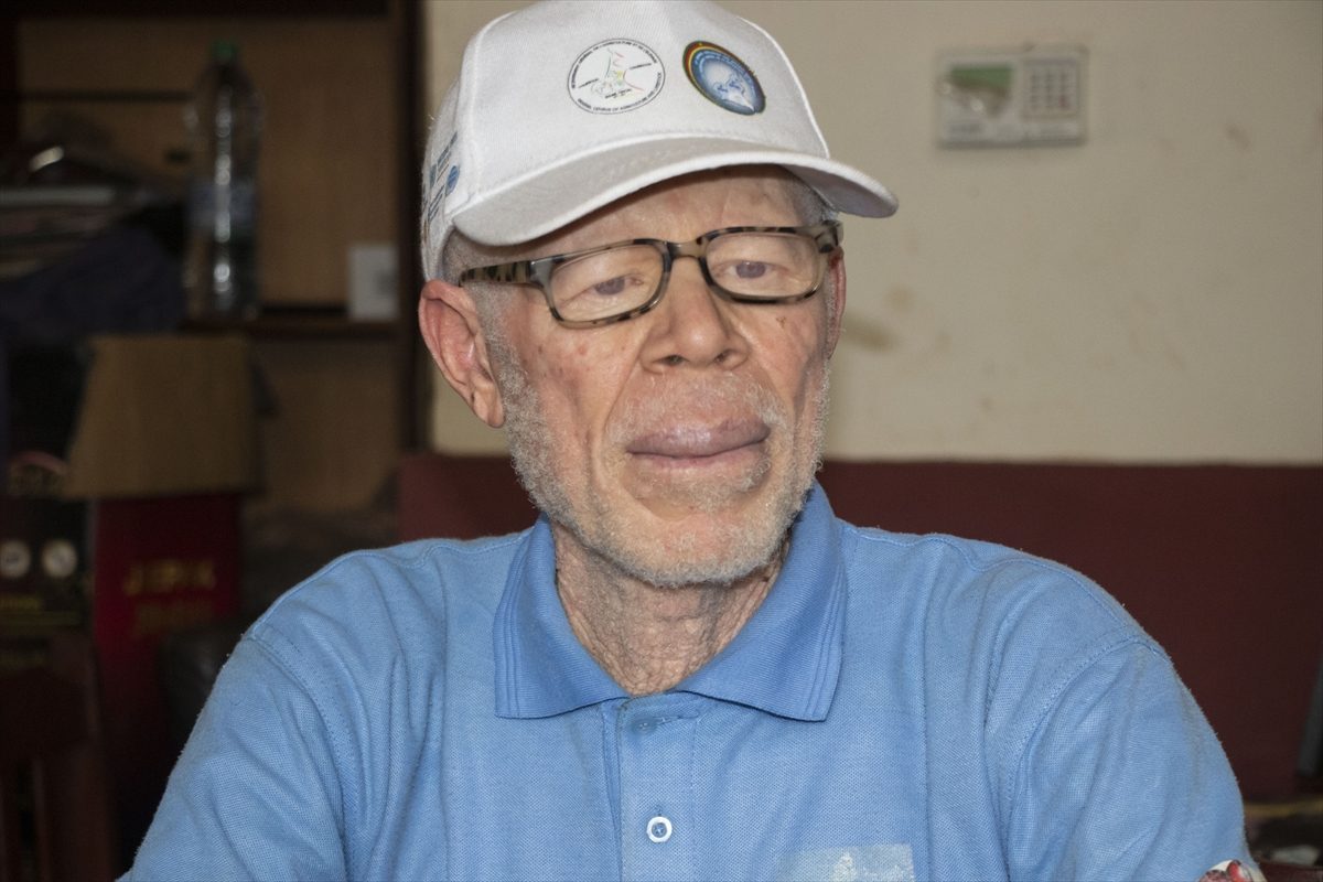 Kamerun’da albino bireyler eğitim, sağlık ve istihdamda zorluklarla karşılaşıyor