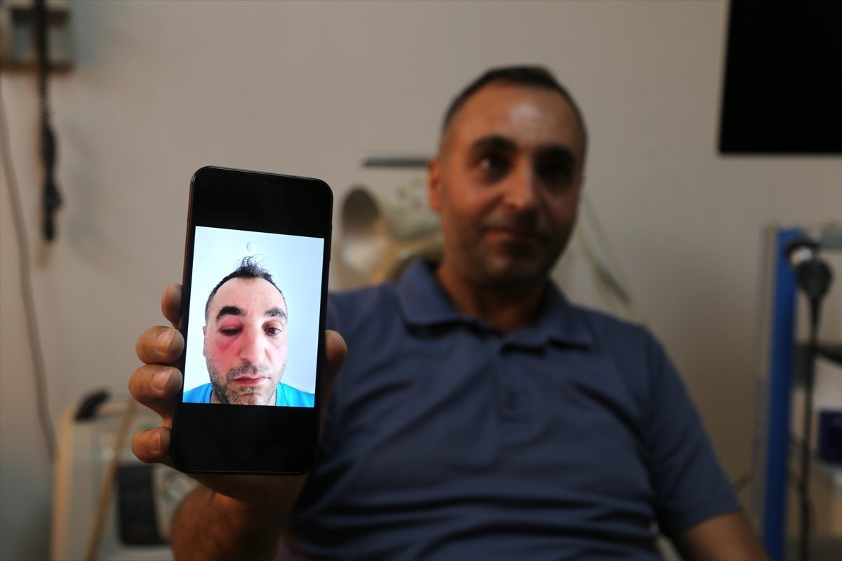 Bitlis’te gözyaşı kanalı tıkanıklığı endoskopik yöntemle tedavi edildi