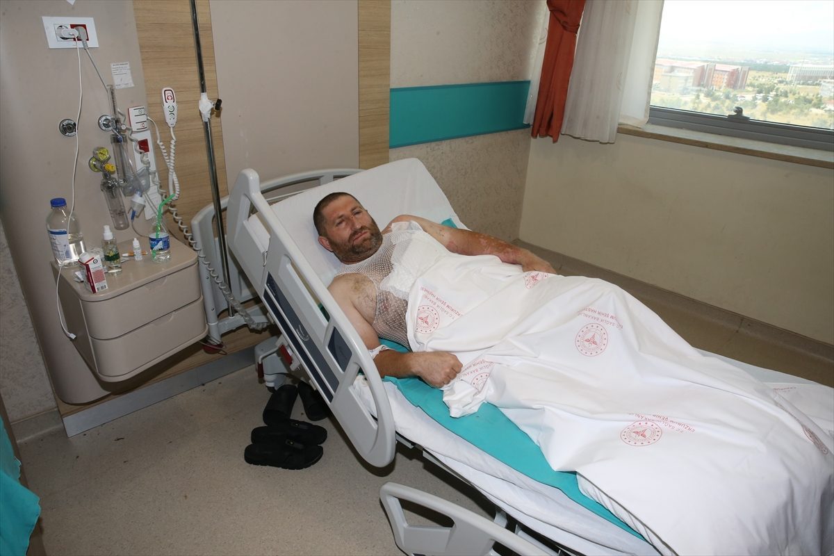 Yüksek gerilim hattında akıma kapılan Erzincanlı demir ustasının tedavisi sürüyor
